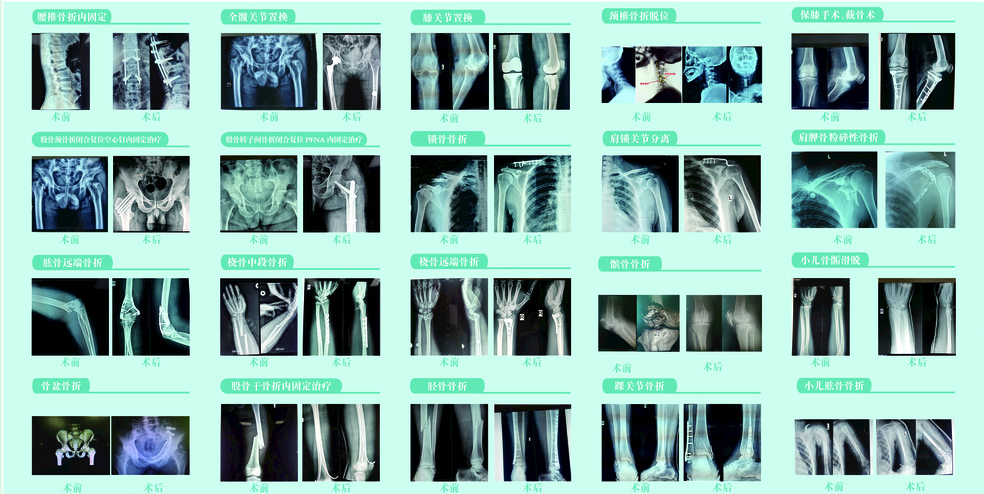 骨科用图片.jpg